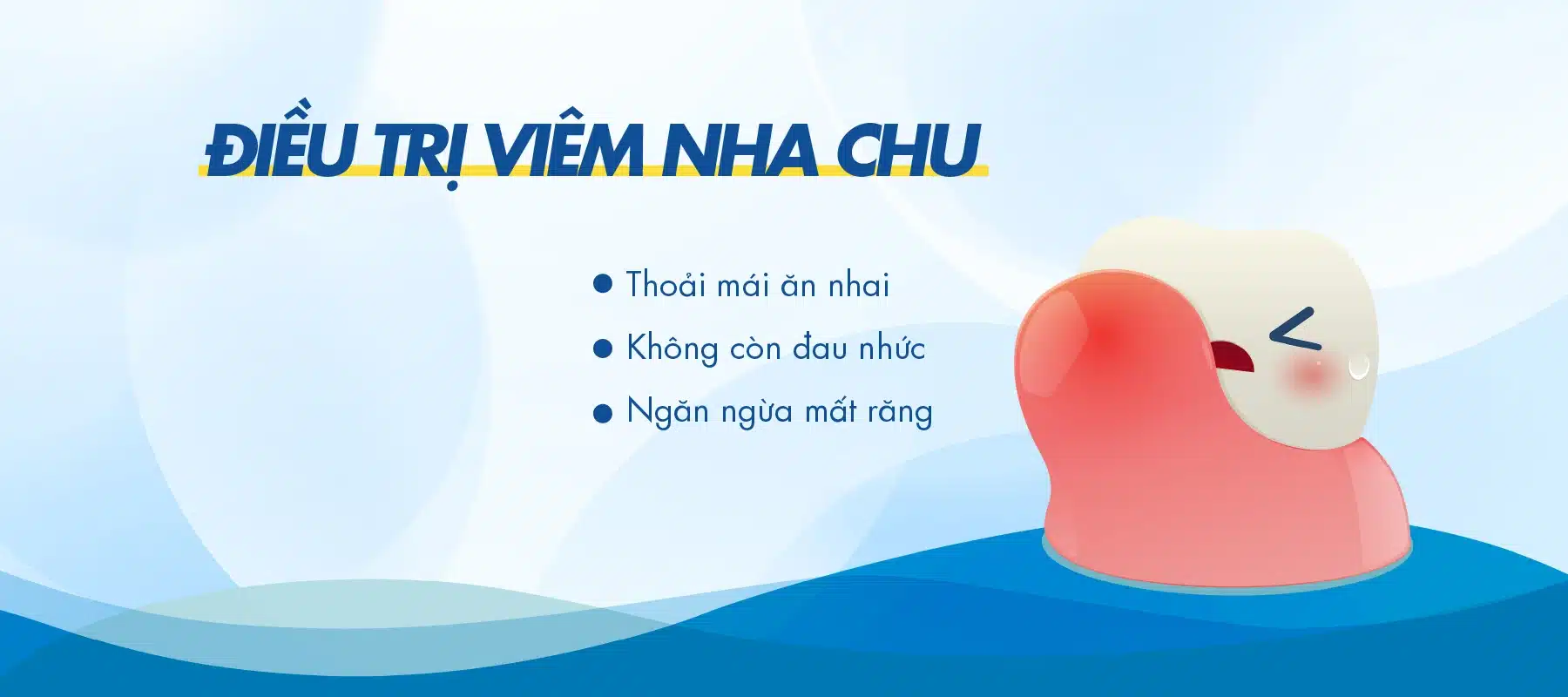 Banner Dieu Tri Viem Nha Chu