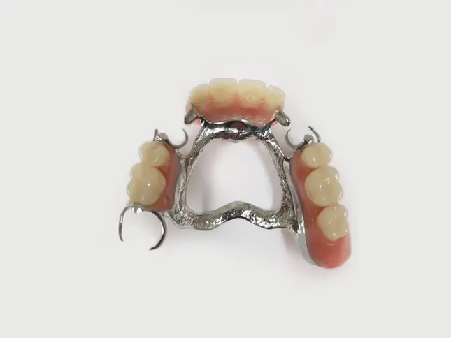 Rang Gia Thao Lap Bang Khung Kim Loai