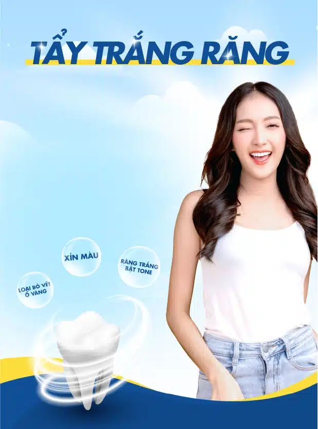TẨy-trẮng-rĂng-mobile
