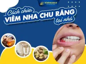 Cach Chua Viem Nha Chu Rang Tai Nha