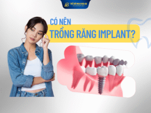Có nên trồng răng implant không