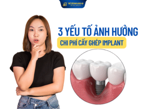 3 Yếu Tố Ảnh Hưởng Đến Chi Phí Cấy Ghép Implant
