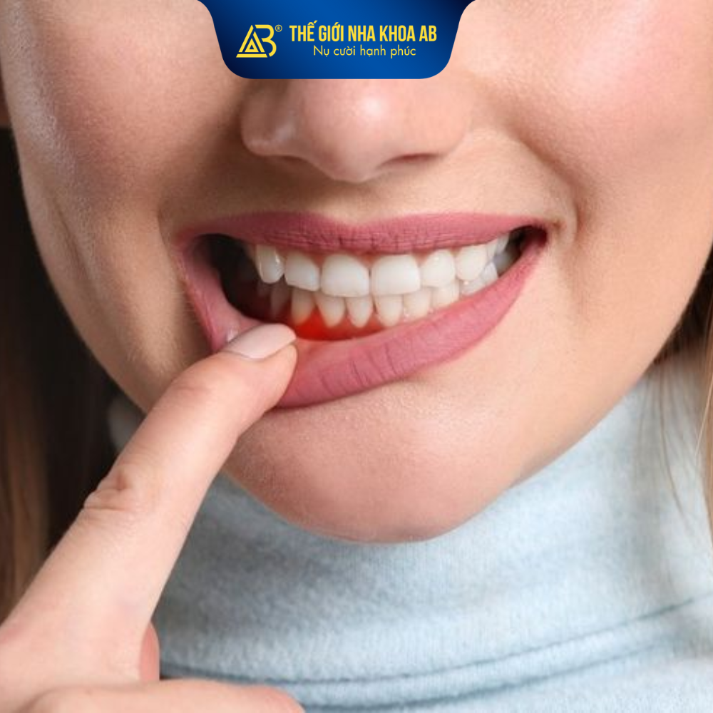 Điều kiện để cấy Implant tức thì