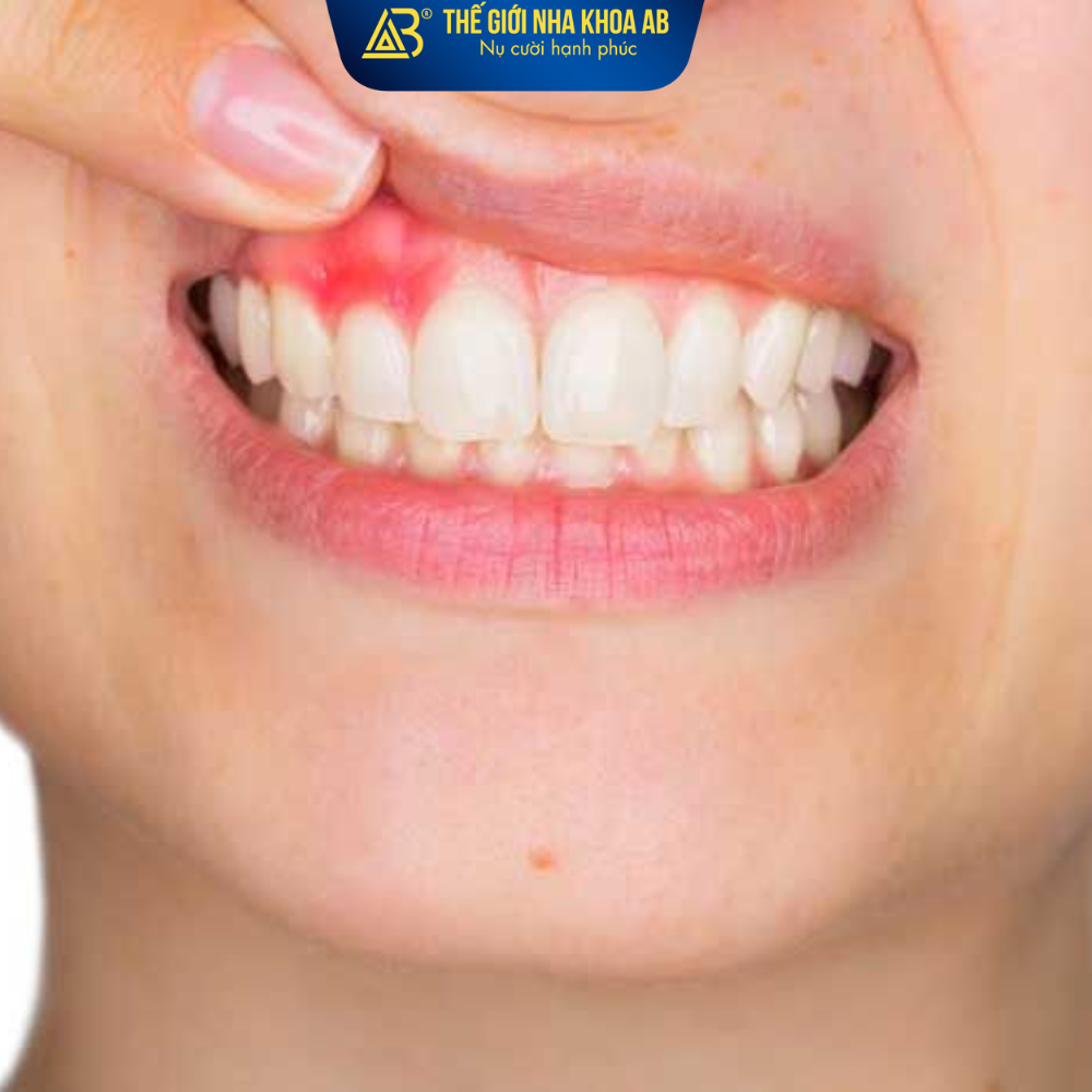 Bệnh lý răng miệng và toàn thân