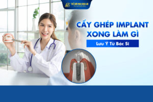 Cấy Ghép Implant Xong Làm Gì