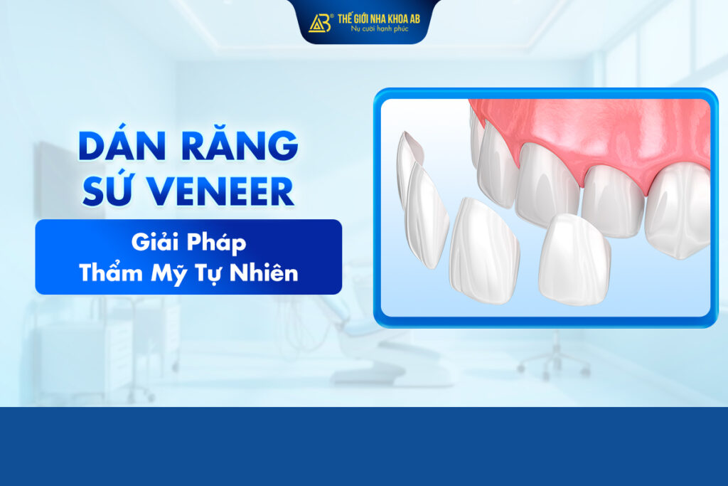 Dán_sứ_veneer_là_gì (1)
