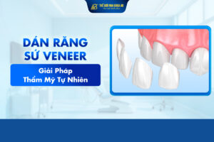 Dán_sứ_veneer_là_gì (1)