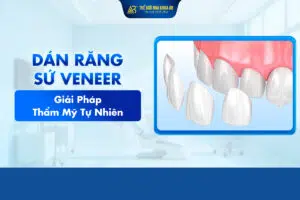 Dán_sứ_veneer_là_gì (1)