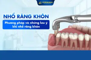Nhổ_răng_khôn