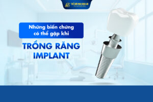 Những Biến Chứng Có Thể Gặp Khi Trồng Răng Implant