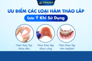 Ưu_ĐiỂm_hÀm_thÁo_lẮp