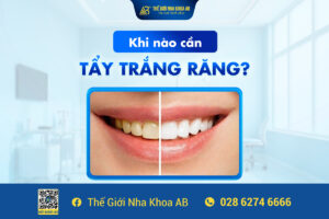 Khi NÀo CẦn TẨy TrẮng RĂng