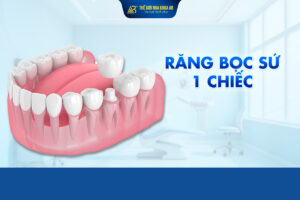 RĂng_bỌc_sỨ_1_chiẾc