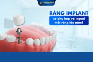 RĂng_implant_cÓ_phÙ_hỢp_vỚi_ngƯỜi_mẤt_rĂng_lÂu_nĂm