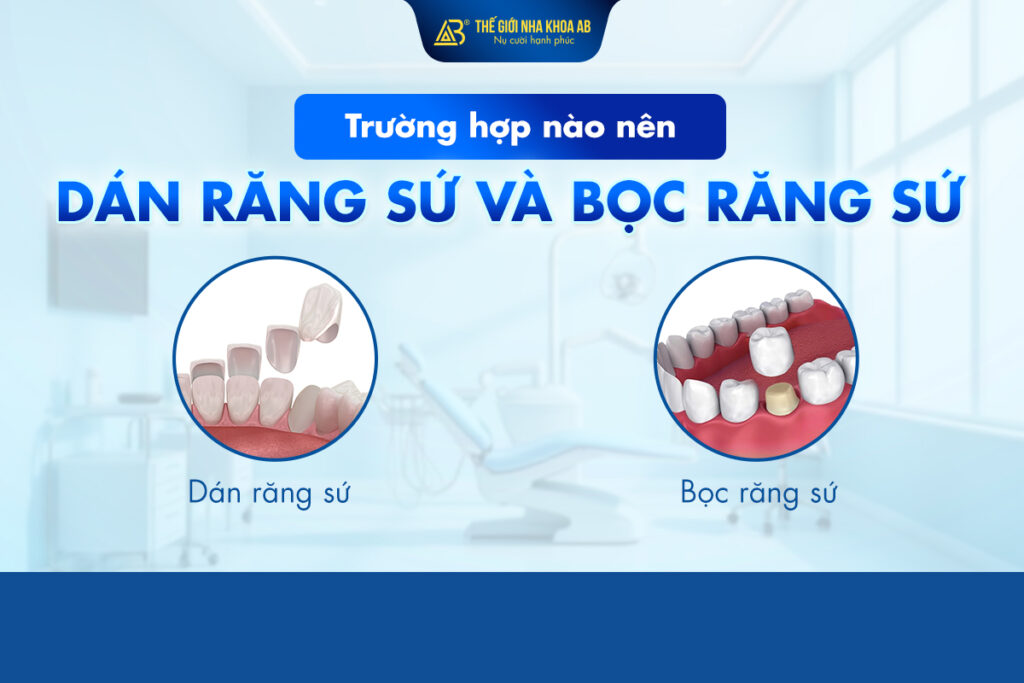 TrƯỜng_hỢp_nÀo_nÊn_dÁn_rĂng_sỨ_vÀ_bỌc_rĂng_sỨ