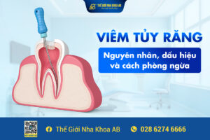 ViÊm TỦy RĂng NguyÊn NhÂn, DẤu HiỆu VÀ CÁch PhÒng NgỪa