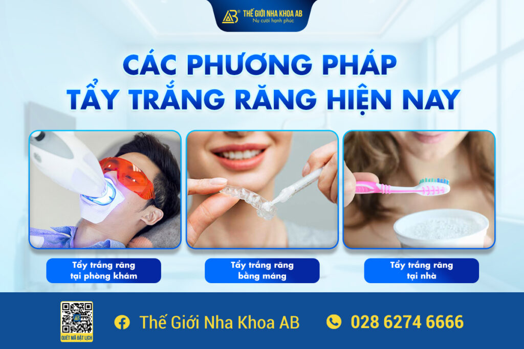 CÁc PhƯƠng PhÁp TẨy TrẮng RĂng HiỆn Nay