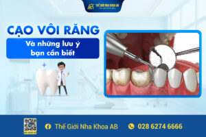 CẠo_vÔi_rĂng_vÀ_nhỮng_lƯu_Ý_bẠn_cẦn_biẾt