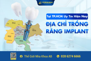 ĐỊa_chỈ_trỒng_rĂng_implant_tẠi_tp.hcm_uy_tÍn_hiỆn_nay