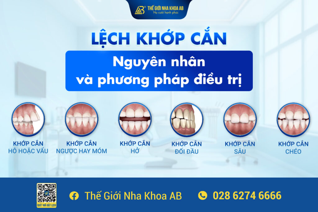 LỆch_khỚp_cẮn_nguyÊn_nhÂn_vÀ_phƯƠng_phÁp_ĐiỀu_trỊ