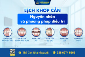 LỆch_khỚp_cẮn_nguyÊn_nhÂn_vÀ_phƯƠng_phÁp_ĐiỀu_trỊ