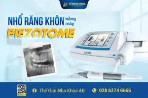 NhỔ RĂng KhÔn BẰng MÁy SiÊu Âm Piezotome