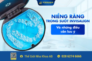 NiỀng RĂng Trong SuỐt Invisalign VÀ NhỮng ĐiỀu CẦn LƯu Ý