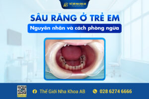 SÂu_rĂng_Ở_trẺ_em_nguyÊn_nhÂn_vÀ_cÁch_phÒng_ngỪa