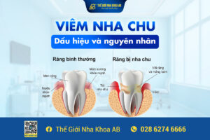 ViÊm Nha Chu DẤu HiỆu VÀ NguyÊn NhÂn