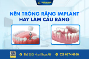 Nên_trồng_răng_implant_hay_làm_cầu_răng