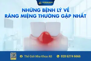 Những Bệnh Lý Về Răng Miệng Thường Gặp Nhất