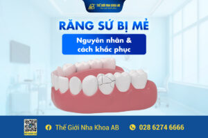 Răng Sứ Bị Mẻ Nguyên Nhân Và Cách Khắc Phục