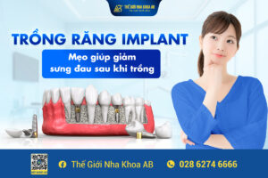 Trồng_răng_implant_mẹo_giúp_giảm_sưng_Đau_sau_khi_trồng