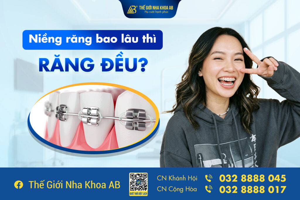 Niềng Răng Bao Lâu Thì Răng Đều