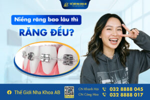 Niềng Răng Bao Lâu Thì Răng Đều