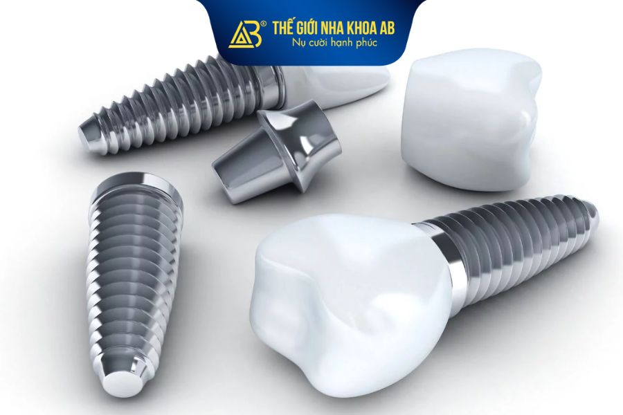 Giá trụ Implant Hàn Quốc thường dao động trong khoảng 10 – 25 triệu đồng