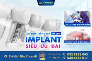 Giá Cấy Ghép Implant
