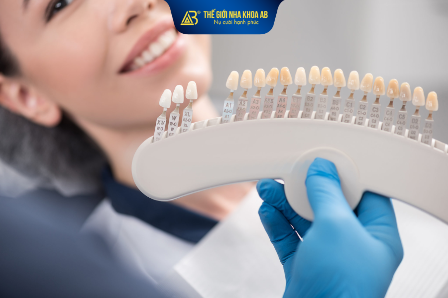 Ưu nhược điểm thường gặp của phương pháp dán sứ veneer