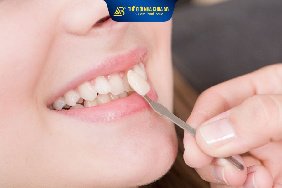Mỗi loại mặt dán sứ sẽ có đặc tính riêng về cấu trúc