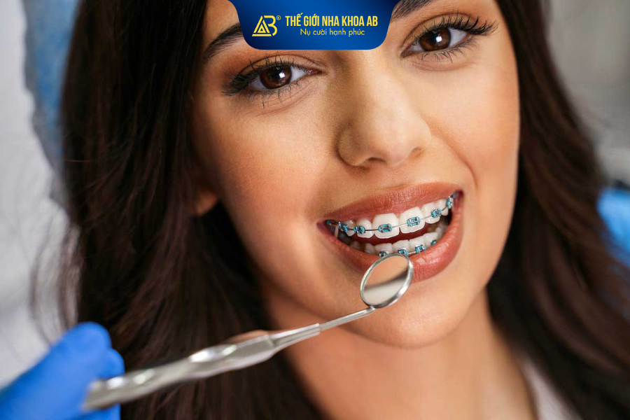 Niềng răng mùa hè giúp nhiều người có thêm thời gian chăm sóc và thích nghi