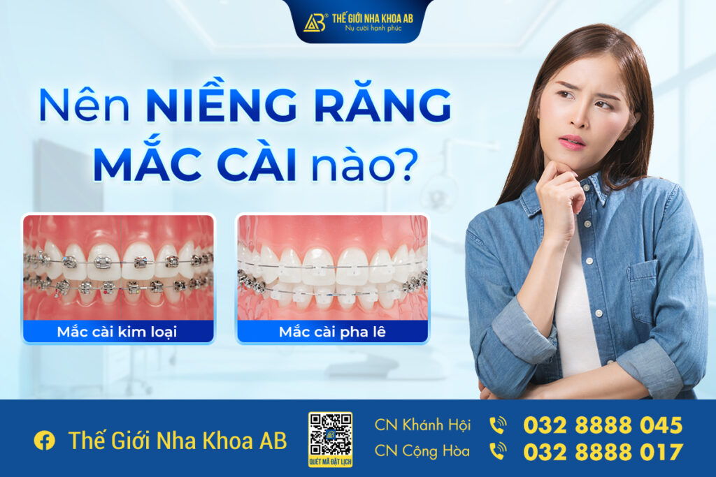 Niềng Răng Mắc Cài Nào