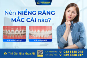 Niềng Răng Mắc Cài Nào