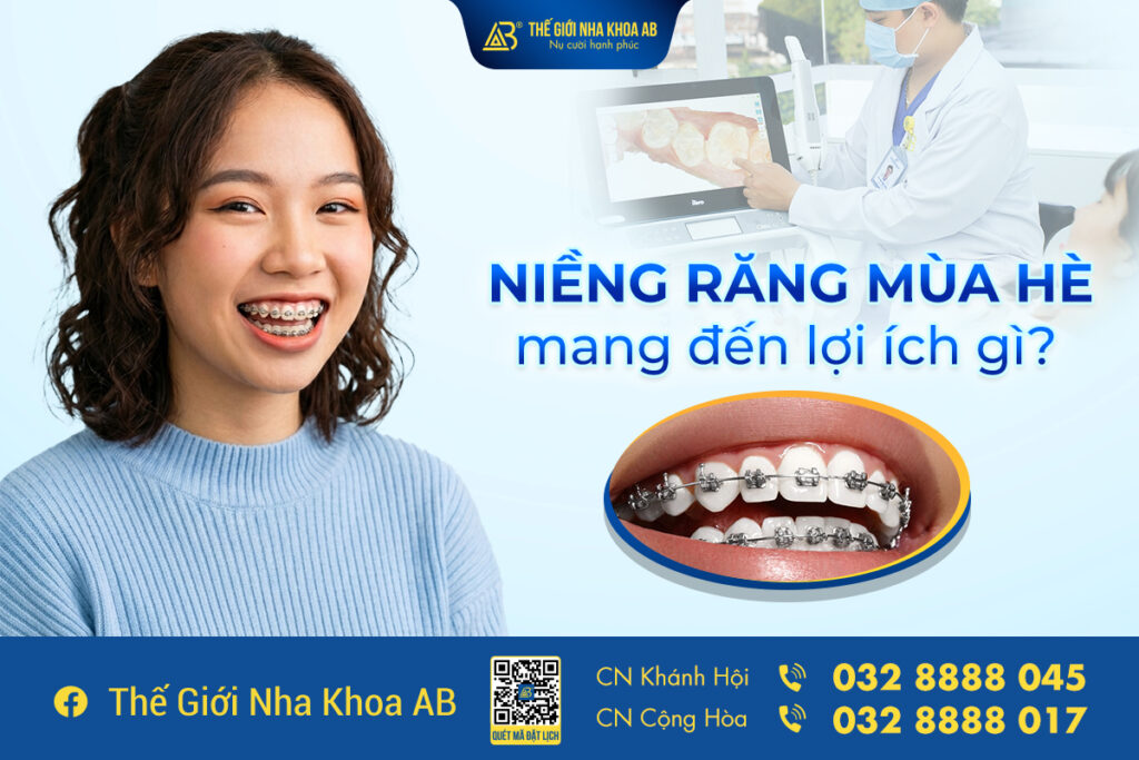 Niềng Răng Mùa Hè