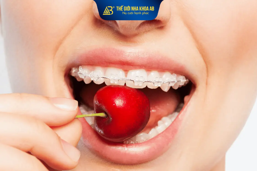 Niềng răng mùa hè giúp thuận tiện điều chỉnh thói quen ăn uống